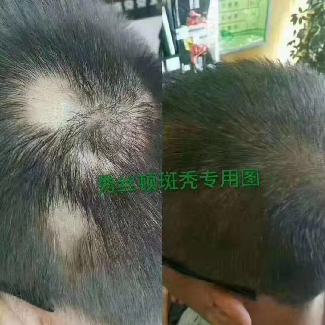 植物养发连锁加盟